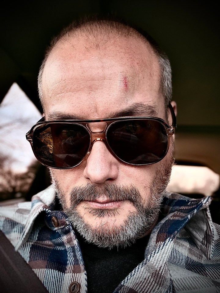 Your author, wearing sunglasses and grimacing on Christmas morning due to the massive contusion on his forehead, gifted to him by his dresser late Christmas Eve. Yes, he was sober...he's just an enormous klutz.